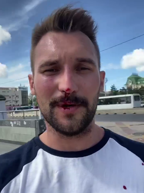 Sergei Naumov after the beating / A still from Tatyana Usmanova's video