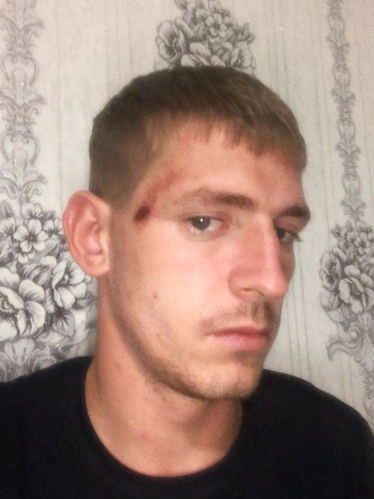 Sergei Plotnikov with a scratch from the beating / Photo: Sergei Plotnikov’s archive